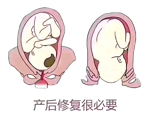 產(chǎn)后恢復(fù)項(xiàng)目好不好，兩大指標(biāo)尤為關(guān)鍵