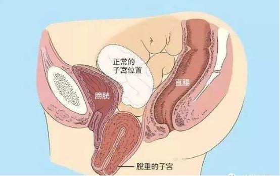 產(chǎn)后康復(fù)是否可以選擇儀器？