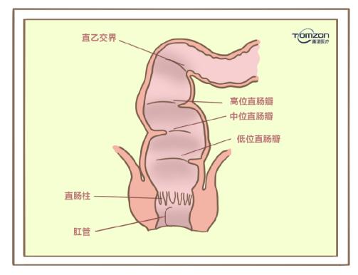 盆底康復(fù)治療儀對產(chǎn)后便秘有哪些幫助？