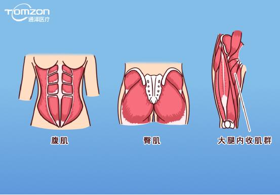 凱格爾運(yùn)動(dòng)該怎么做？盆底肌修復(fù)儀器效果會(huì)更好嗎？