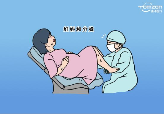 盆底康復(fù)治療儀是否可以促進盆底肌肉康復(fù)？